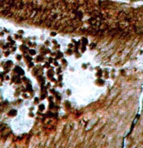 angular clots in Ankyropteris