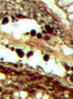 clots of various sizes and shapes in Ankyropteris, no coprolites