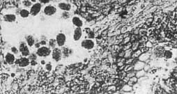 big and small angular clots in Ankyropteris