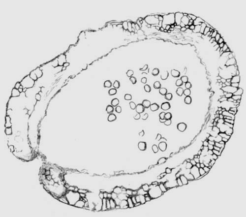 Nothia sporangium, Wandstruktur