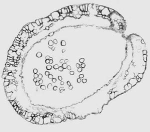 Nothia sporangium