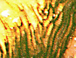 Trichopherophyton tracheid wall pattern