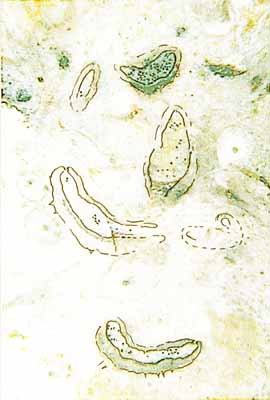 6 Trichopherophyton-Sporangien, Konturen