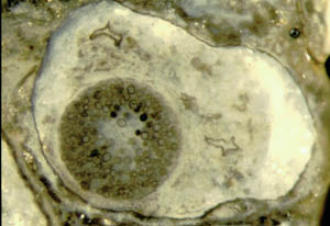 spherical chlamydospore filled with little spheres in decayed Rhynia