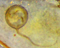 Chlamydospore mit Hyphe