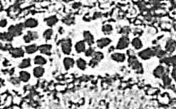 angular clots in Psaronius