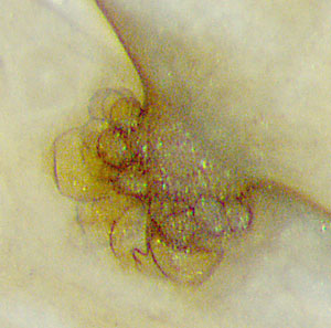 unknown fungus vesicles