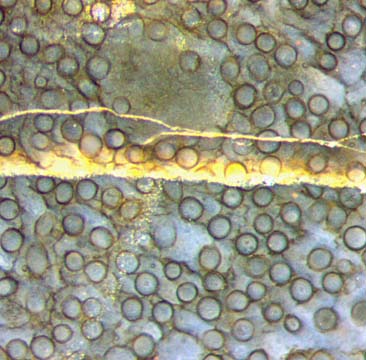 nematophyte with clot