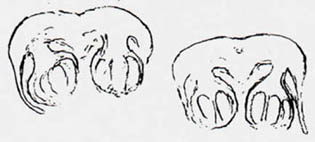 Scolecopteris pinnule cross-sections, distinct synangium stalks