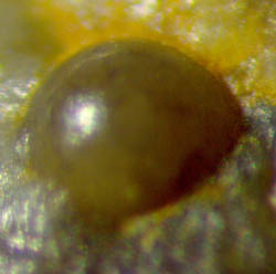 Fungus resting spore protruding from  the sample surface
