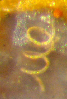 Nematoplexus spiral
