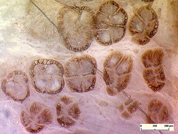 Scolecopteris-Synangien mit 3 bis 5 Sporangien