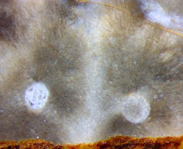 Croftalania on chlamydospores