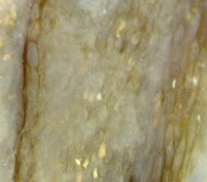 Ventarura tissue layers